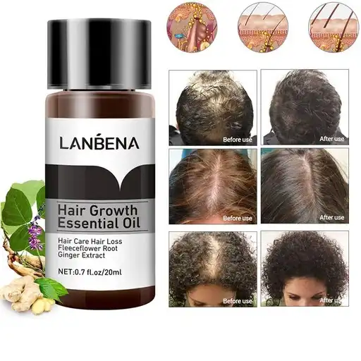 روغن تقویت و رشد مو لانبنا مناسب ضد ریزش مو و ضخیم کننده تارهای مو کد 0380